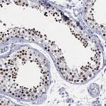 SSX1 Antibody in Immunohistochemistry (Paraffin) (IHC (P))