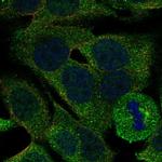 PLA2G4E Antibody in Immunocytochemistry (ICC/IF)