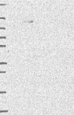 PHF17 Antibody in Western Blot (WB)