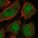 PTF1A Antibody in Immunocytochemistry (ICC/IF)