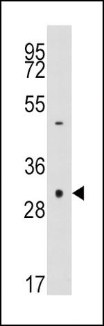 Caspase 3 Antibody in Western Blot (WB)