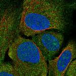 CRHR2 Antibody in Immunocytochemistry (ICC/IF)