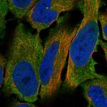 LHR Antibody in Immunocytochemistry (ICC/IF)