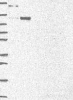 AXIN1 Antibody in Western Blot (WB)