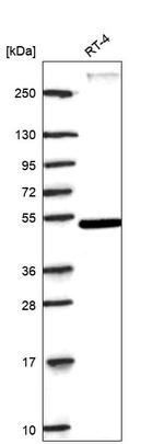 RORA Antibody in Western Blot (WB)