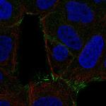 SPTLC2 Antibody in Immunocytochemistry (ICC/IF)