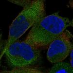 Shootin1 Antibody in Immunocytochemistry (ICC/IF)