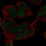 HAND1 Antibody in Immunocytochemistry (ICC/IF)