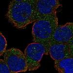 Alsin Antibody in Immunocytochemistry (ICC/IF)