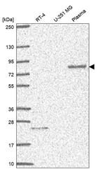 MCTP1 Antibody in Western Blot (WB)