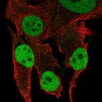 MKP2 Antibody in Immunocytochemistry (ICC/IF)