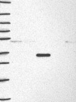 MKP2 Antibody in Western Blot (WB)