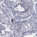 SPPL2C Antibody in Immunohistochemistry (Paraffin) (IHC (P))