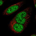 UHMK1 Antibody in Immunocytochemistry (ICC/IF)