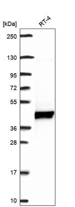 UHMK1 Antibody in Western Blot (WB)