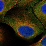 STRA8 Antibody in Immunocytochemistry (ICC/IF)