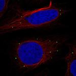 RTN2 Antibody in Immunocytochemistry (ICC/IF)