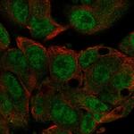 METTL3 Antibody in Immunocytochemistry (ICC/IF)