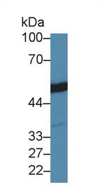 beta Tubulin Antibody in Western Blot (WB)