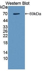 Galectin 9 Antibody in Western Blot (WB)