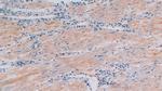 Procollagen I C-Peptide Antibody in Immunohistochemistry (Paraffin) (IHC (P))