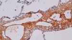 Procollagen I C-Peptide Antibody in Immunohistochemistry (Paraffin) (IHC (P))