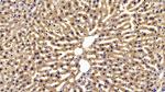 FABP1 Antibody in Immunohistochemistry (Paraffin) (IHC (P))