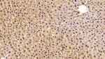 FABP1 Antibody in Immunohistochemistry (Paraffin) (IHC (P))