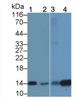 FABP1 Antibody in Western Blot (WB)