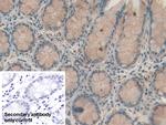 RBP2 Antibody in Immunohistochemistry (Paraffin) (IHC (P))