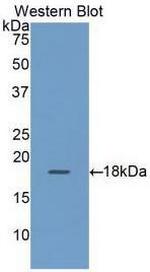 RBP2 Antibody in Western Blot (WB)