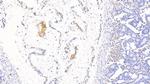 Hemoglobin Antibody in Immunohistochemistry (Paraffin) (IHC (P))