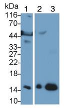 Hemoglobin Antibody in Western Blot (WB)