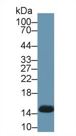 Hemoglobin Antibody in Western Blot (WB)