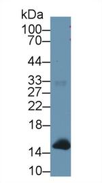 Hemoglobin Antibody in Western Blot (WB)