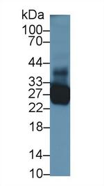 TNNI1 Antibody in Western Blot (WB)