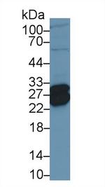 TNNI1 Antibody in Western Blot (WB)