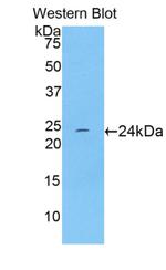 TNNI1 Antibody in Western Blot (WB)