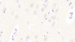 GP6 Antibody in Immunohistochemistry (Paraffin) (IHC (P))