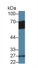 GP6 Antibody in Western Blot (WB)