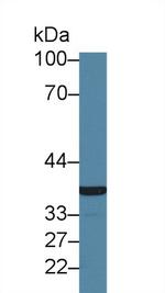 GP6 Antibody in Western Blot (WB)