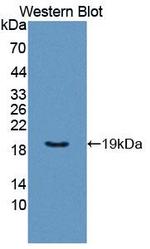 GP6 Antibody in Western Blot (WB)