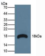 RNASE3 Antibody in Western Blot (WB)