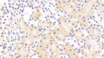 NUP88 Antibody in Immunohistochemistry (Paraffin) (IHC (P))