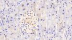 NUP88 Antibody in Immunohistochemistry (Paraffin) (IHC (P))