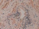 CD200 Antibody in Immunohistochemistry (Paraffin) (IHC (P))