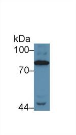 Complement C4 Antibody in Western Blot (WB)