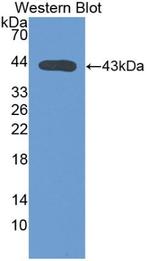 Complement C4 Antibody in Western Blot (WB)