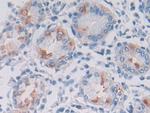 LPHN3 Antibody in Immunohistochemistry (Paraffin) (IHC (P))