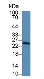 NME5 Antibody in Western Blot (WB)